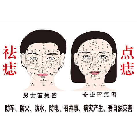 小黑痣|痣